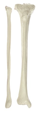 Os de la jambe (tibia et péroné/fibula)