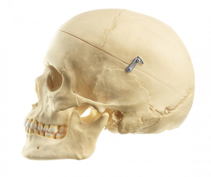 Artificial Human Skull, Female