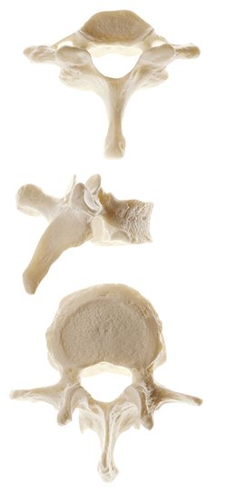 Vertebre singole