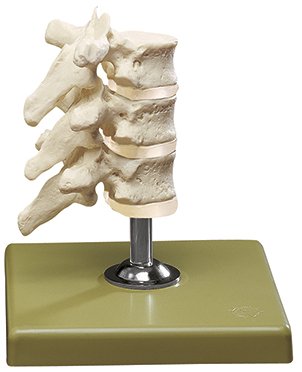 Three Thoracic Vertebrae with Discs