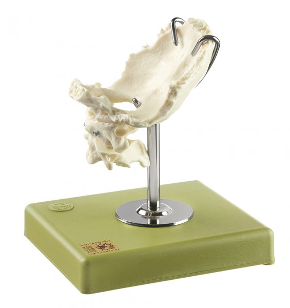 Atlas, Axis, and Squamous Part of the Occipital Bone