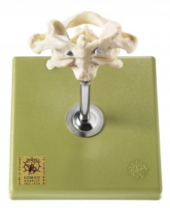 Primera y segunda vértebras cervicales (atlas y axis) Primera y segunda vértebras cervicales (atlas y axis)