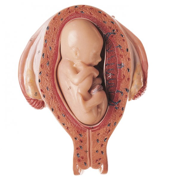 Uterus mit Fetus im 5. Monat