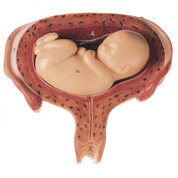 Uterus mit Fetus im 5. Monat