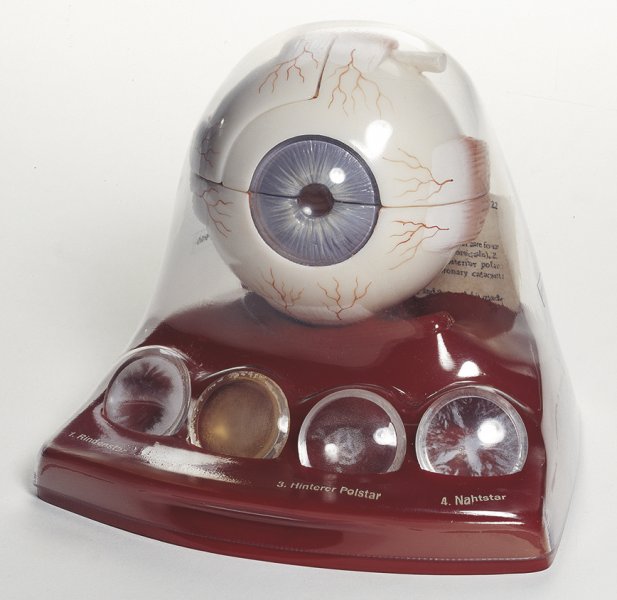 Cataract Eye Model