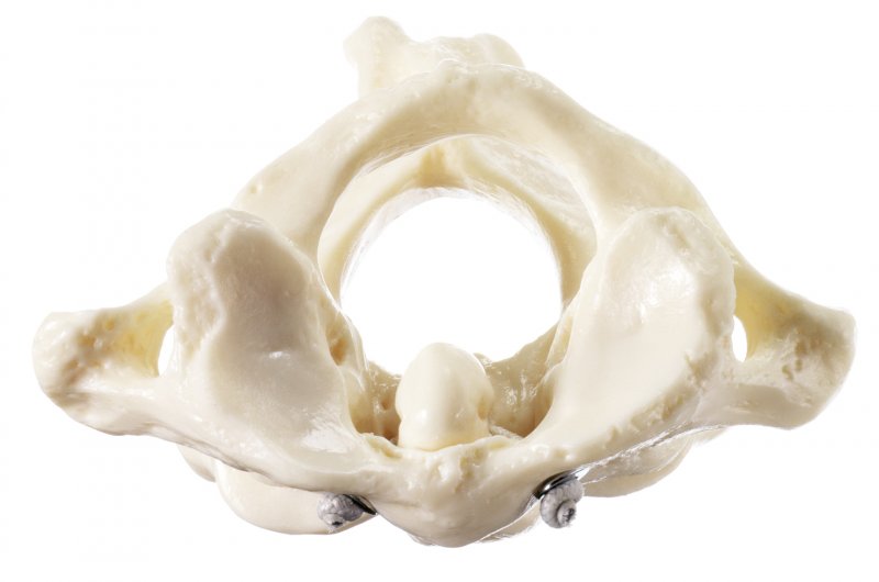 First and Second Cervical Vertebrae