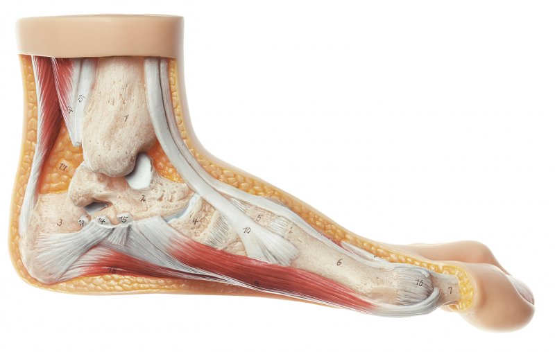 Modell vom Hallux valgus