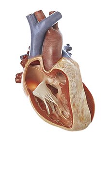 Fallot's Tetralogy