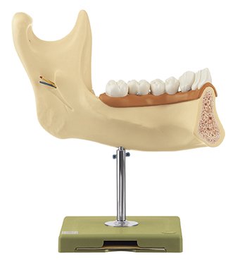 Mandibule d'un individu de dix huit ans