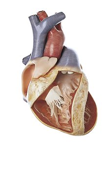 Total Atrioventricular Canal