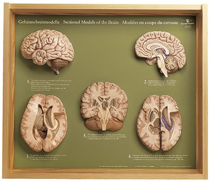 5 Gehirnschnittmodelle