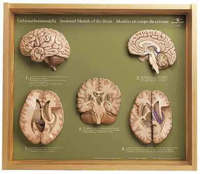 5 coupes du cerveau