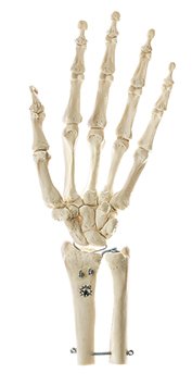Squelette de la main avec insertion sur l’avant-bras, (montage fixe)