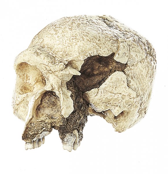 Skull of the Steinheim Prehistoric Man, Homo steinheimensis