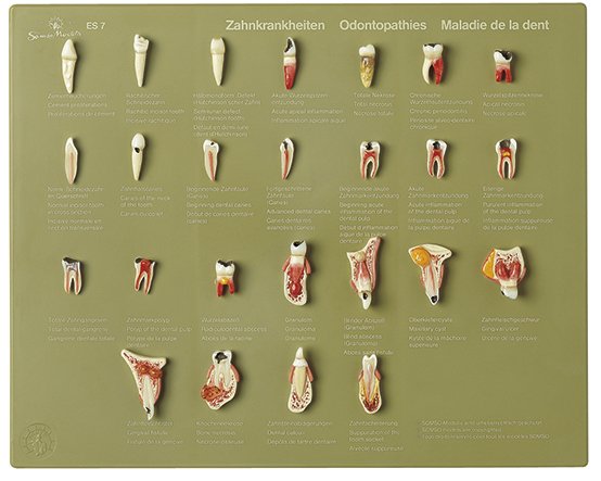 Serie di denti