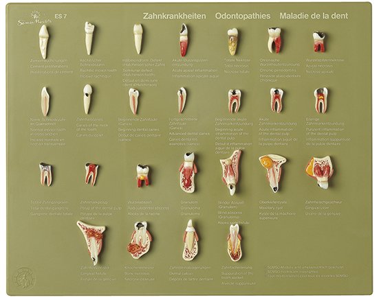 Vitrina «Enfermedades dentales»