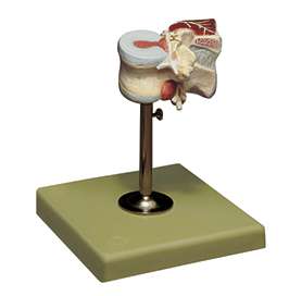 Segments of the Spine › Anatomy models | SOMSO®
