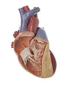 Diversos defectos del tabique interventricular