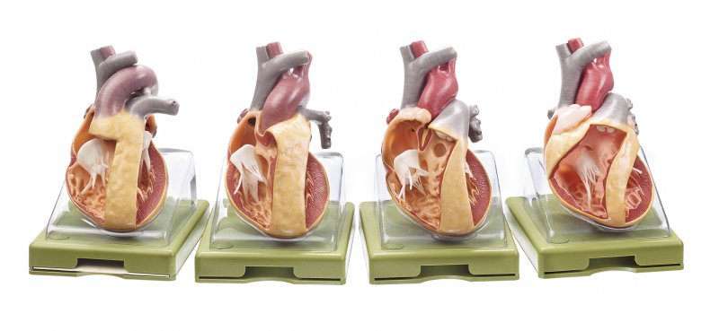 Serie de modelos con representación de cardiopatías congénitas