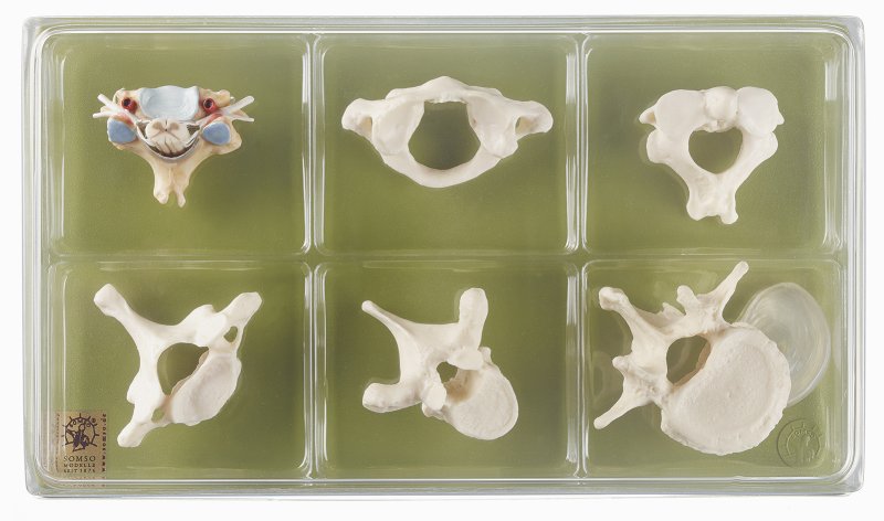 Collection Case “Vertebrae and Spinal Cord“