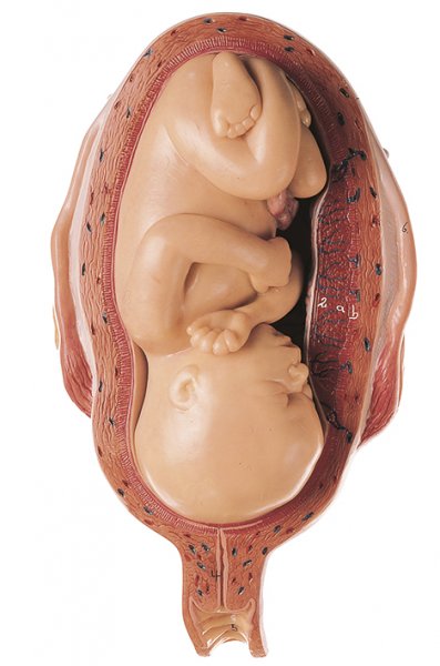 Uterus with Fetus in Seventh Month