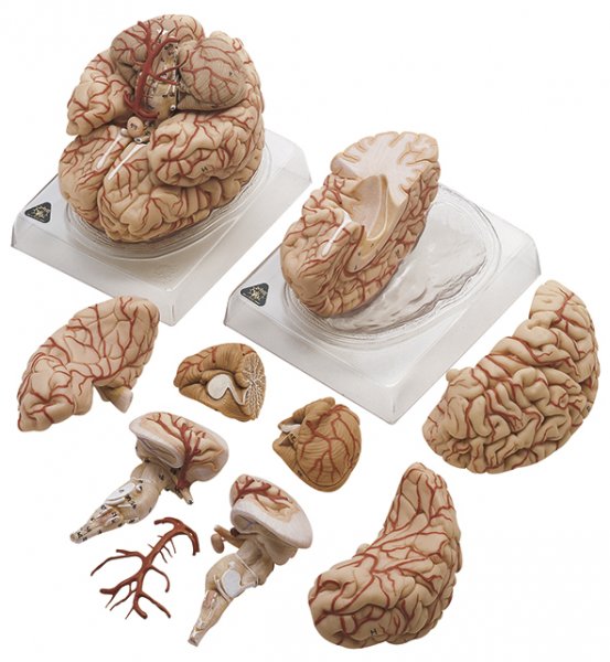Cervello con arterie